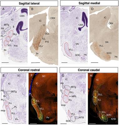 Molecular identity of the lateral lemniscus nuclei in the adult mouse brain